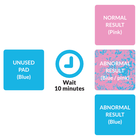 Diagram showing the three possible outcomes from a sweat function test (pink, blue and pink / blue mixed)