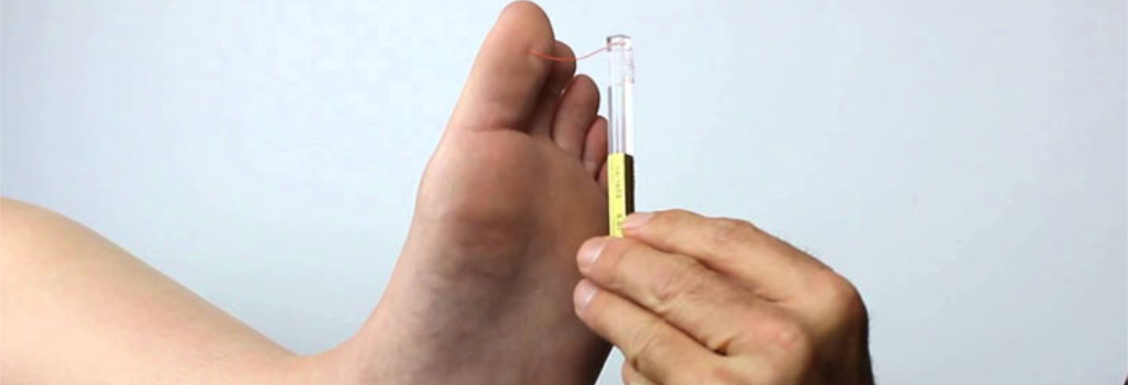 Monofilament testing on a patient's foot