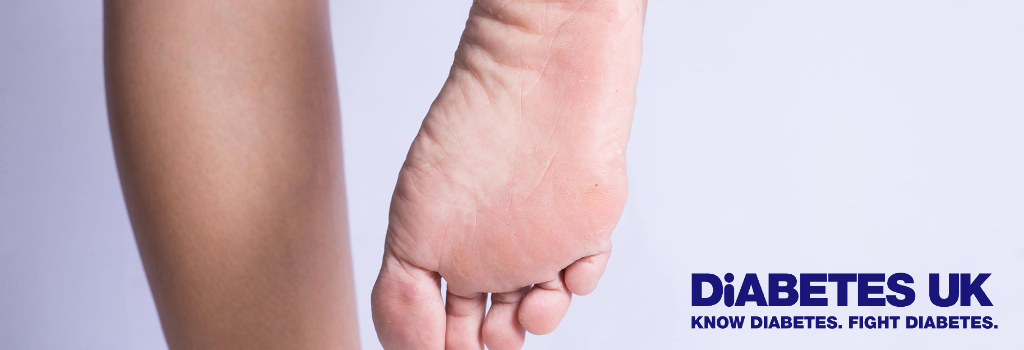 Image of a foot with the Diabetes UK logo