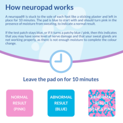 Neuropad changes pink to show a normal result. If any pink remains, then this is positive for sudomotor disfunction.