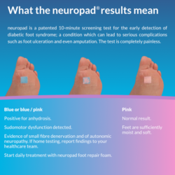 Neuropad changes pink to show a normal result. If any pink remains, then this is positive for sudomotor disfunction.