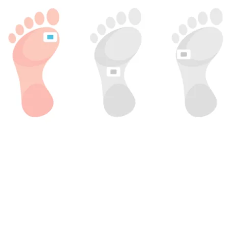 Three images of feet showing the possible positions where a Neuropad could be applied.