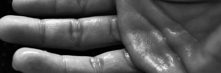A close-up picture of a sweating hand
